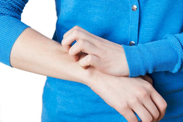 eczeme due to GLA deficiency from not taking evening primrose oil