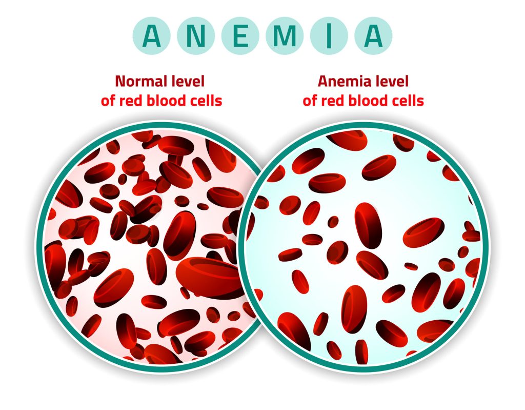 low level of red blood cells with anemia in menopause