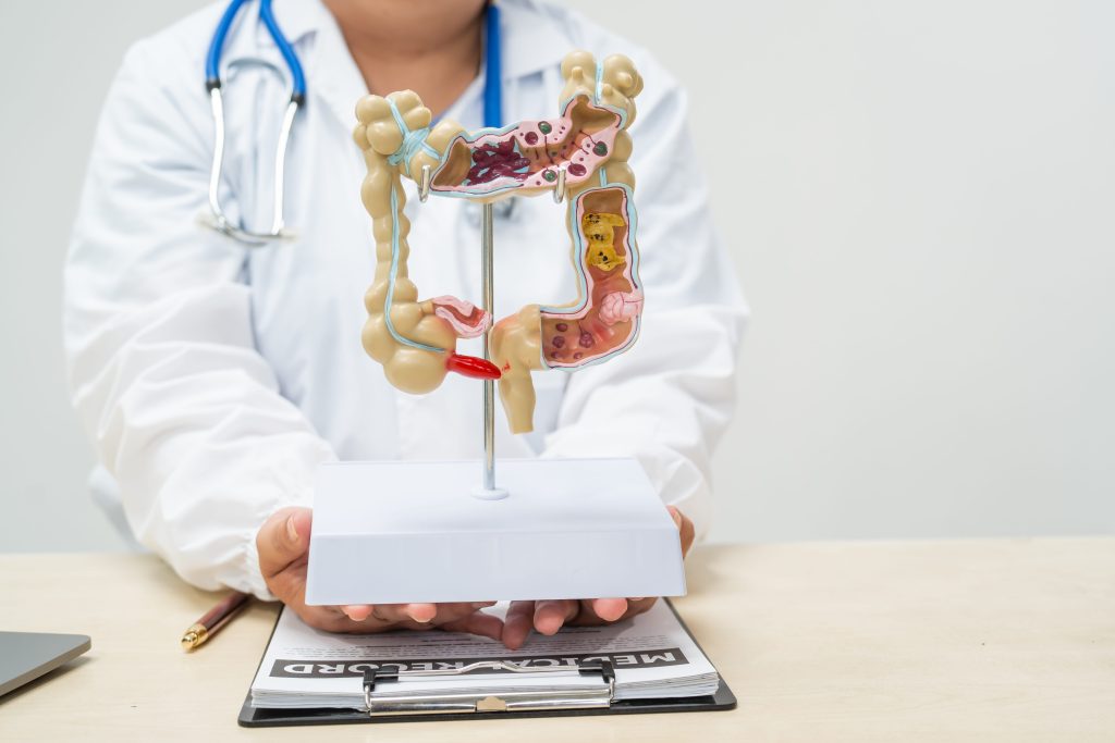 Medical illustration of gut regeneration.