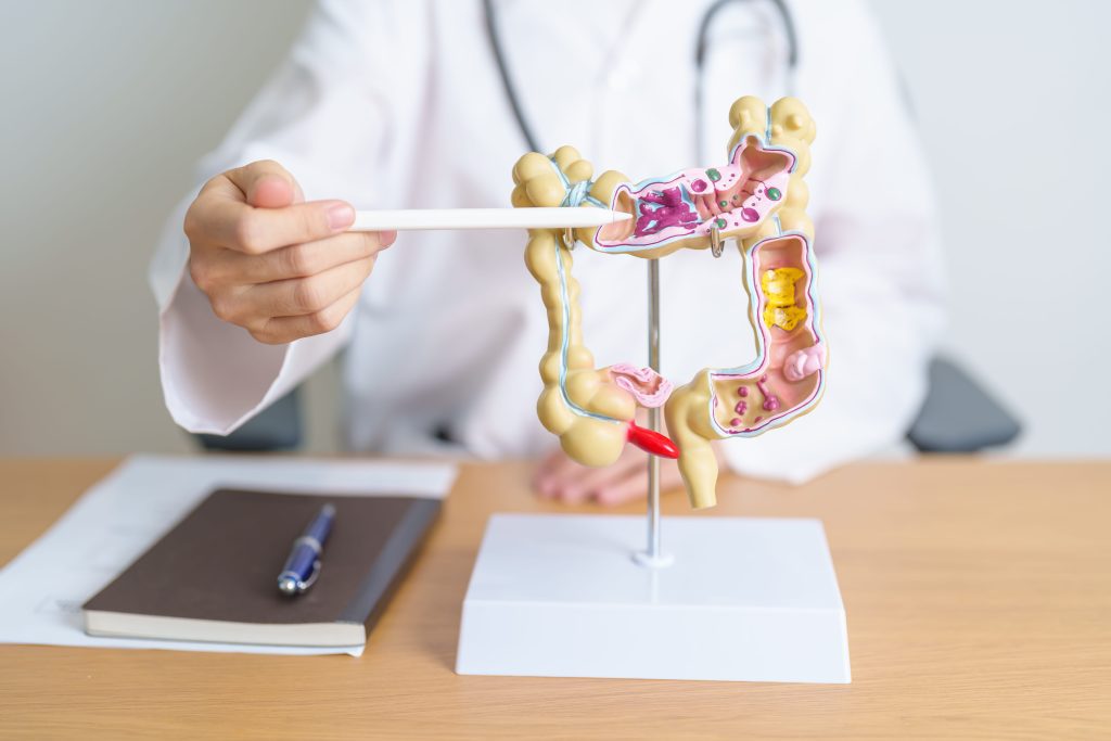 Illustration of the intestinal lining and gut bacteria showing how leaky gut symptoms begin